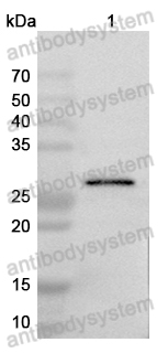 Anti-Monkeypox virus/MPXV H3L Polyclonal Antibody